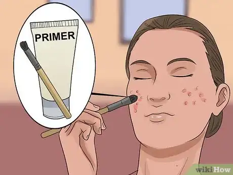 Image intitulée Deal With Pimples Step 7