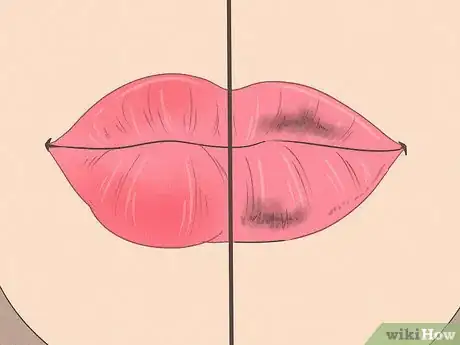 Image intitulée Make Your Lips Bigger Step 37