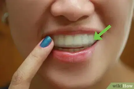 Image intitulée Whiten Your Teeth Without Spending a Lot of Money Step 2