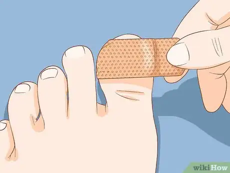 Image intitulée Help a Toenail Grow Back Quickly Step 7