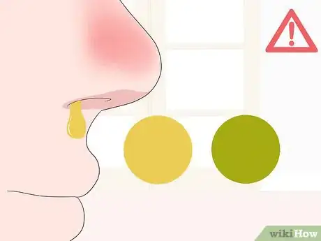 Image intitulée Clear a Stuffy Nose Step 17