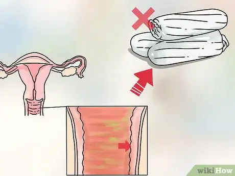 Image intitulée Know the Signs of Miscarriage Step 9