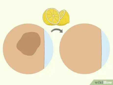 Image intitulée Use a Lemon to Lighten Your Skin Step 2