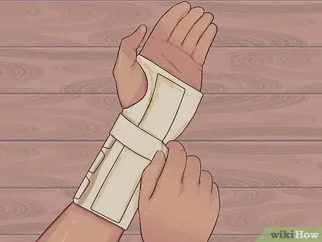 Image intitulée Recover After Carpal Tunnel Release Surgery Step 2