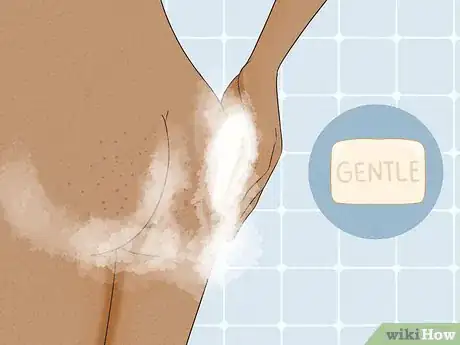 Image intitulée Get Rid of Acne on the Buttocks Step 14