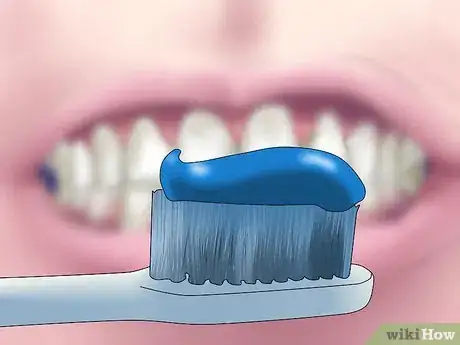 Image intitulée Reverse Dental Bone Loss Step 7