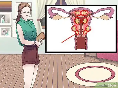 Image intitulée Prevent Uterine Fibroids Step 7