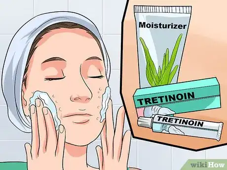Image intitulée Use Tretinoin and Benzoyl Peroxide Concurrently Step 4