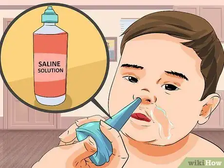 Image intitulée Relieve Stuffy Nose in Toddlers Step 2