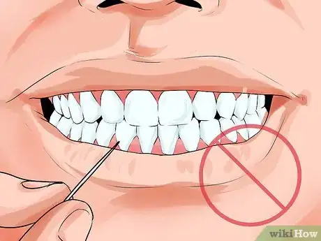 Image intitulée Avoid Dental Crown Problems Step 7