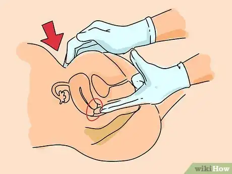 Image intitulée Recognize Cervical Cancer Symptoms Step 5