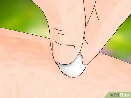 Image intitulée Get Bug Bites to Stop Itching Step 16