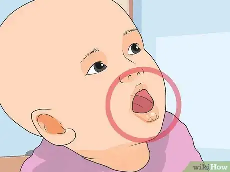 Image intitulée Prevent Infant Dehydration Step 2