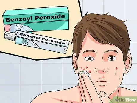 Image intitulée Use Tretinoin and Benzoyl Peroxide Concurrently Step 8