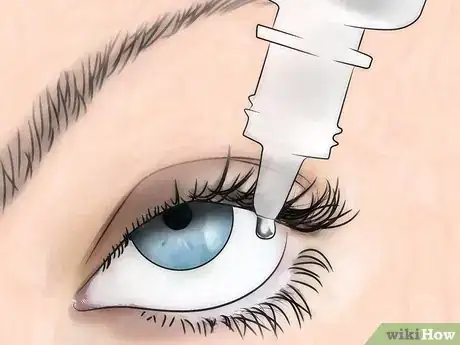 Image intitulée Treat Dry Eyes Step 11