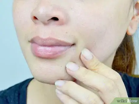 Image intitulée Treat Dry Lips Step 11