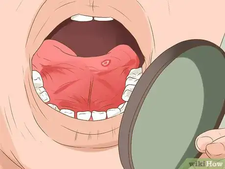 Image intitulée Heal a Bitten Tongue Step 3