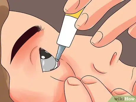 Image intitulée Use Erythromycin Eye Ointment Step 4