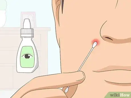 Image intitulée Shrink Pimples Step 9