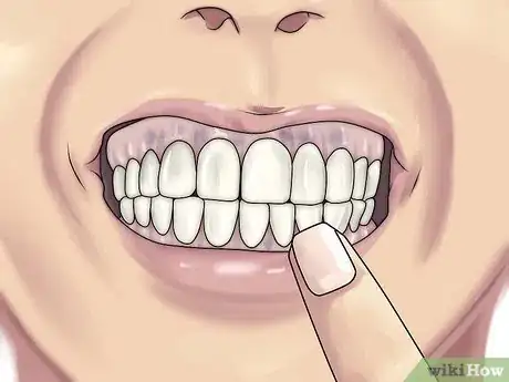 Image intitulée Detect Gum Disease Step 4