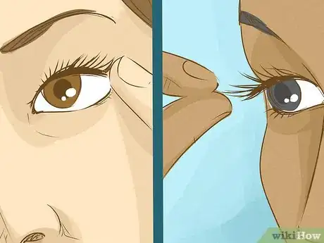 Image intitulée Get an Eyelash Out of Your Eye Step 7