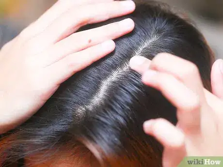 Image intitulée Prevent Head Lice Step 5