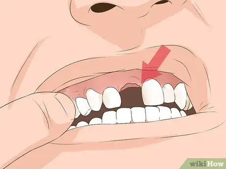 Image intitulée Heal a Bitten Tongue Step 4