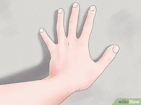 Image intitulée Do Hand Stretches for Carpal Tunnel Step 5