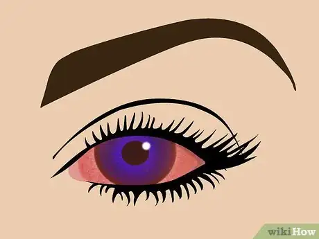 Image intitulée Get Colored Contacts to Change Your Eye Color Step 13