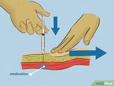 Image intitulée Give an Intramuscular Injection Step 17