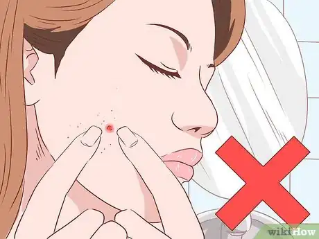 Image intitulée Stop a Zit from Bleeding Step 8