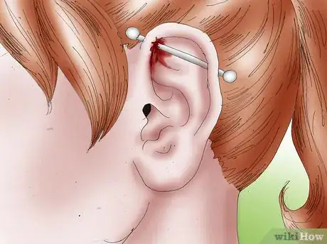 Image intitulée Get an Industrial Piercing Step 20