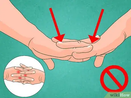 Image intitulée Lose Fat Around the Fingers Step 5