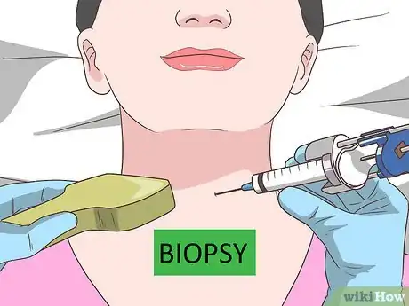 Image intitulée Diagnose Thyroid Cancer Step 10