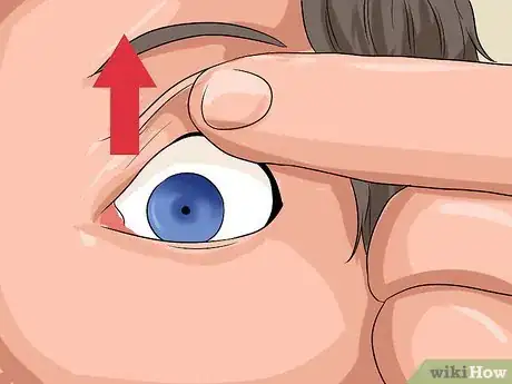 Image intitulée Remove Stuck Contact Lenses Step 3
