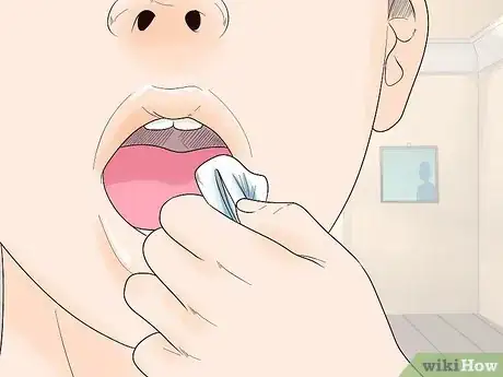 Image intitulée Sleep After Wisdom Teeth Removal Step 1