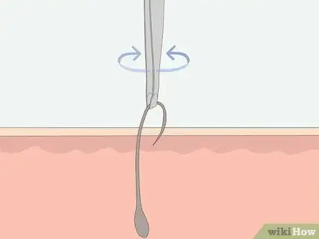 Image intitulée Get Rid of Ingrown Pubic Hair Step 10