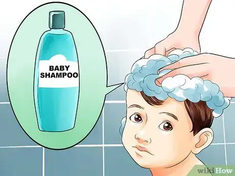 Image intitulée Easily Clean Baby's Cradle Cap Dandruff Without Hurting the Baby Step 2