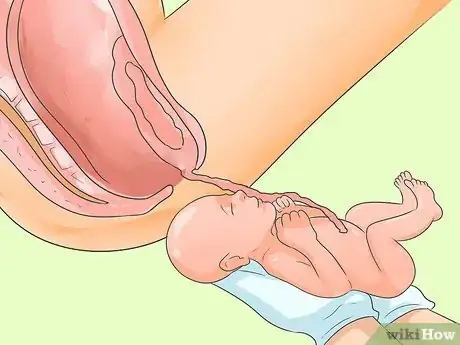 Image intitulée Deliver a Baby Step 18