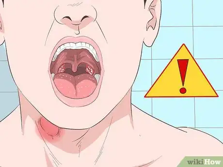 Image intitulée Get Rid of a Sore Throat Quickly Step 20