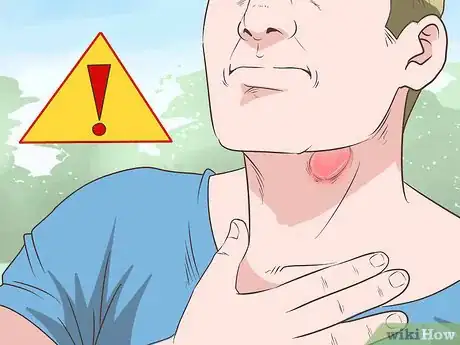 Image intitulée Get Rid of a Sore Throat Quickly Step 19