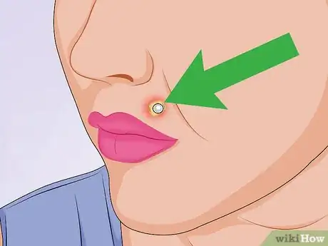 Image intitulée Tell if a Piercing Is Infected Step 5