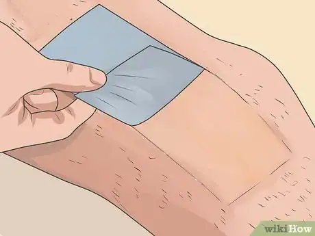 Image intitulée Use Hair Removing Wax Step 6