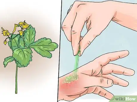 Image intitulée Treat a Sting from a Stinging Nettle Step 7