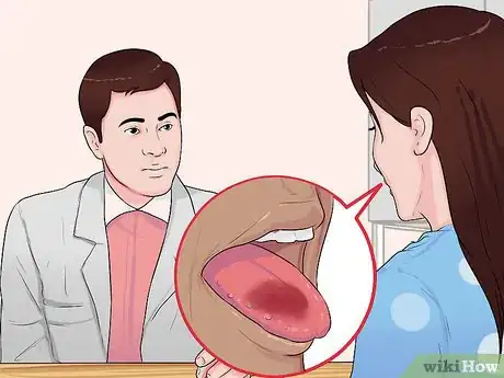 Image intitulée Treat Tongue Burn Blisters Step 14