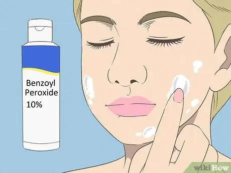 Image intitulée Get Rid of Acne if You Have Fair Skin Step 3