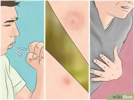 Image intitulée Reduce the Pain of Gnat Bites Step 11