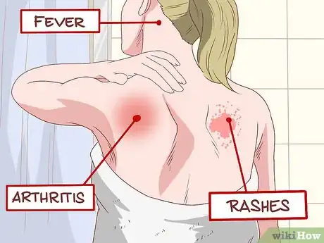 Image intitulée Recover from Chikungunya Step 1