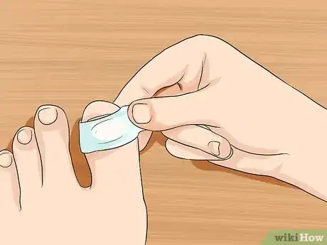 Image intitulée Relieve Ingrown Toe Nail Pain Step 11