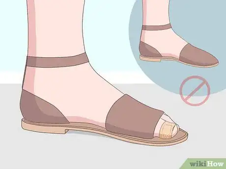 Image intitulée Relieve Ingrown Toe Nail Pain Step 12